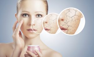Как ухаживать за сухой кожей лица?